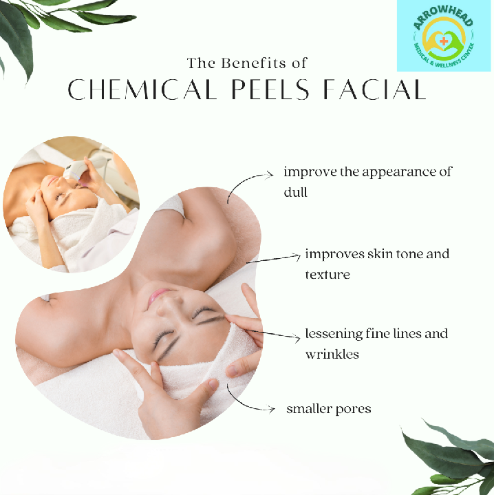 benefits of chemical peels